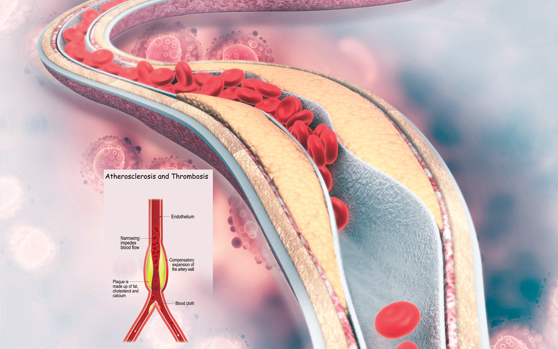 Sugar or Fat? Sugar or Fat?